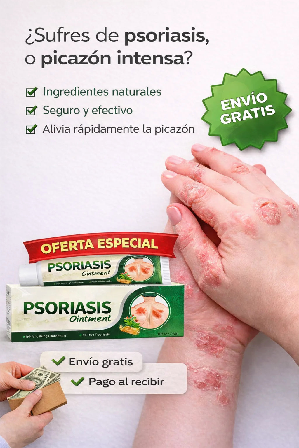 ✅ PSORIASIS™ | Alivia la picazón y el enrojecimiento de la piel desde la primera aplicación ☀️